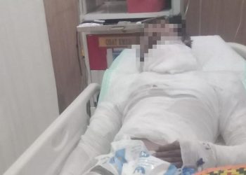 Sopir Truk Bali yang Dibakar Bos Meninggal Setelah Seminggu Kritis