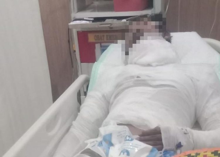 Sopir Truk Bali yang Dibakar Bos Meninggal Setelah Seminggu Kritis